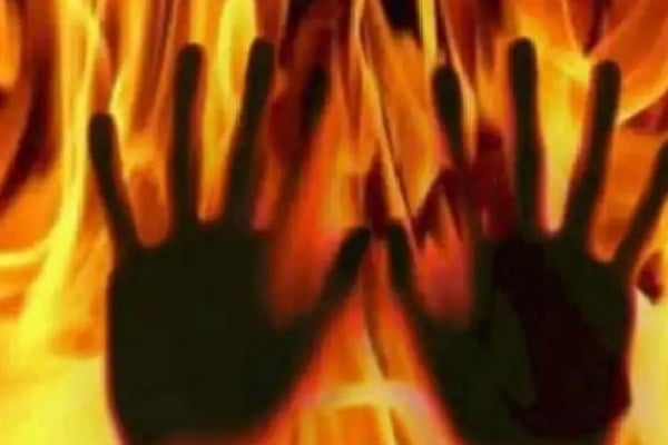 man sets girl ablaze in ap