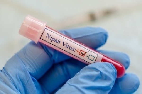 DGCI approves Truenat test kit for diagnosis of Nipah
