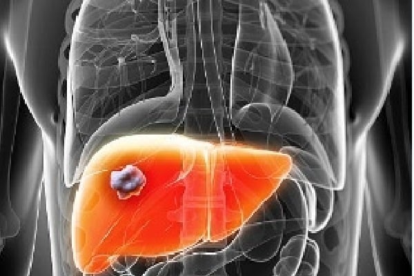 How a toxic liver can affect your health