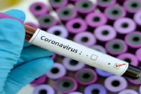 3 foreign nationals test Covid positive in Mathura
