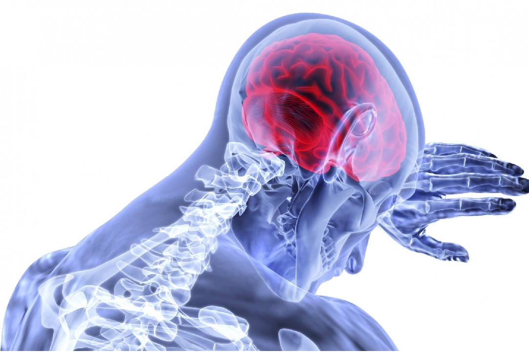 Stroke risk in elderly highest in 3 days after Covid-19 diagnosis
