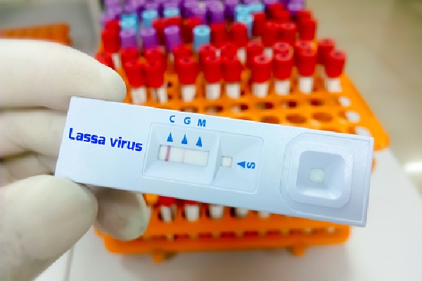 Lassa Fever emerges in Britaine