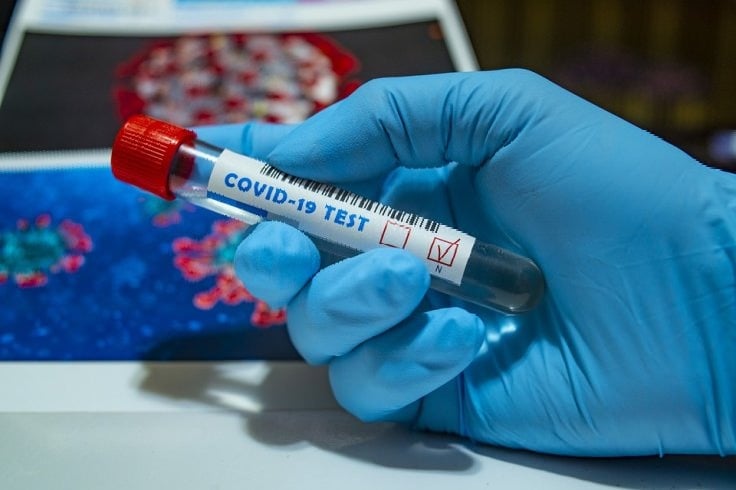 Eight people tested covid positive in AP