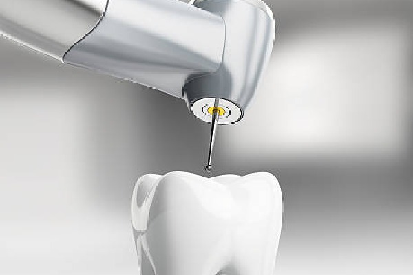 Nano Robots in dental treatment 