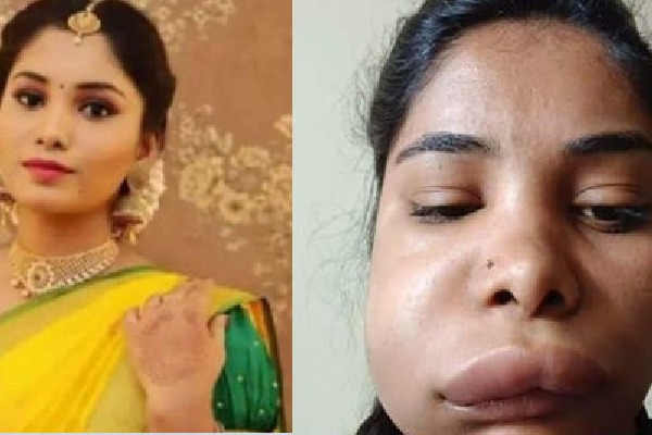 Kannada heroine face changed after root canal treatment