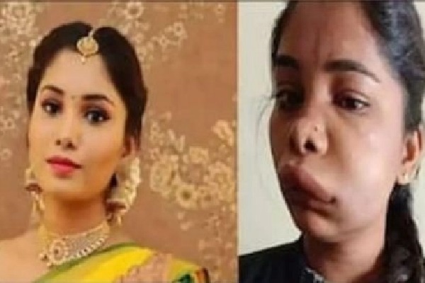 Kannada actress Swathi's face swollen after root canal surgery