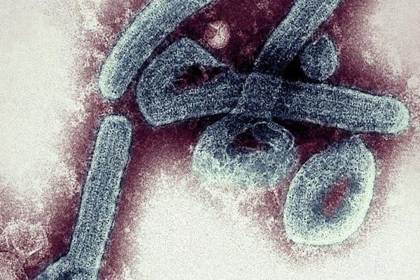 WHO on alert as deadly 'Marburg' virus comes to light in Africa's Ghana