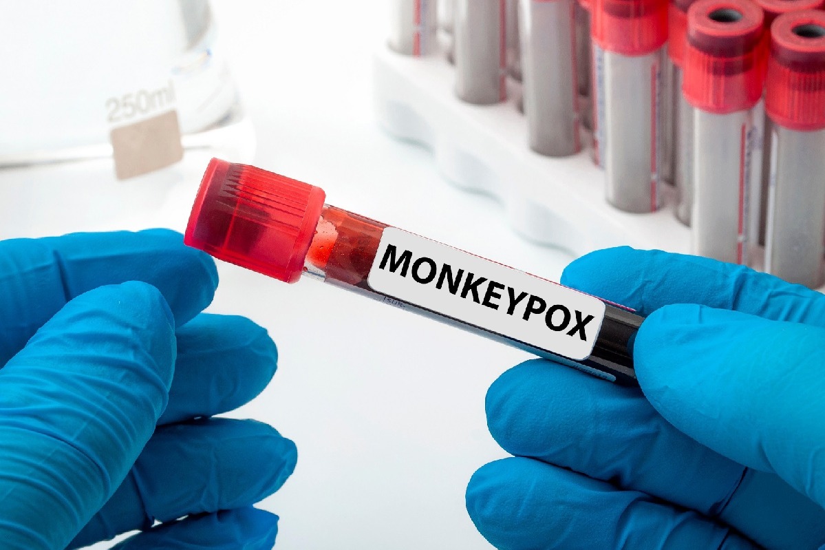 Monkeypox: 95% spread occurred via sexual activity, says study