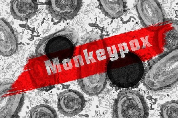 WHO declares world health emergency on Monkeypox spreading 