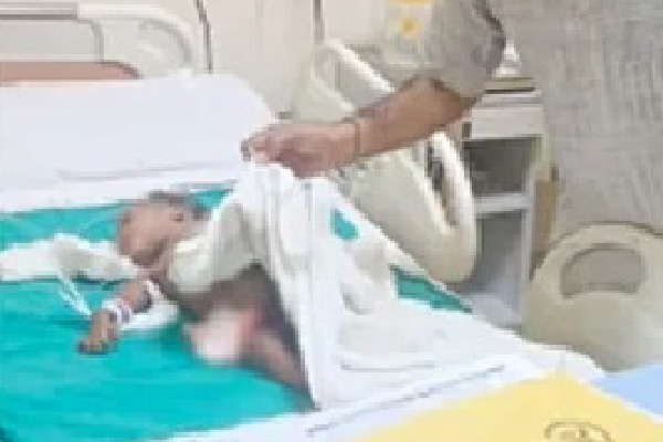 Stray Dog killed infant in Noida