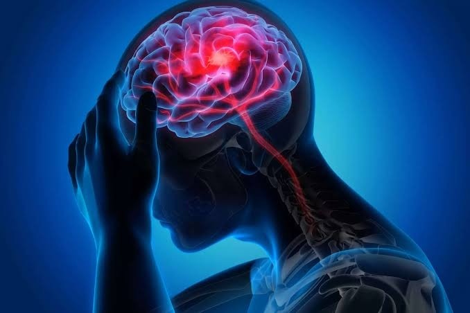 Find these symptoms that indicates Brain stroke early