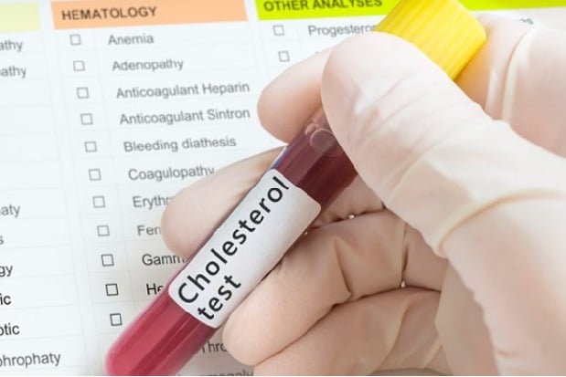 What causes behind High cholesterol risk