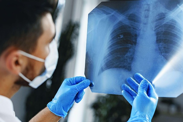 First signs of lung cancer prevention tips by expert