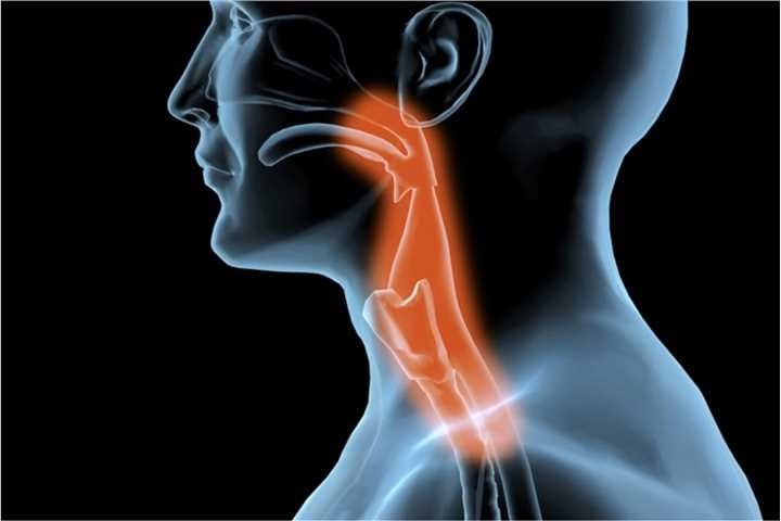 Oesophageal Cancer Risk factors symptoms diagnosis treatment prevention tips
