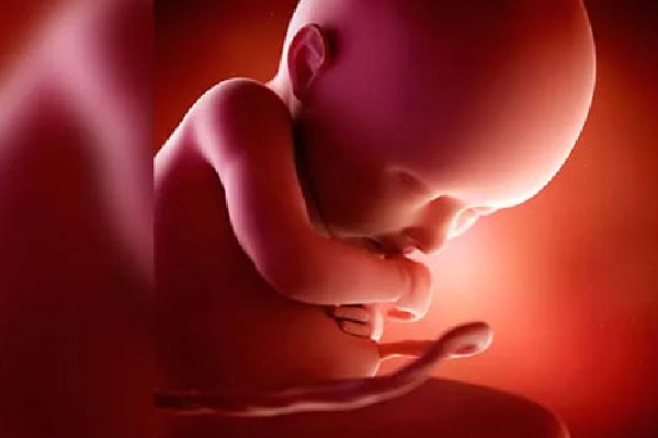 Doctors Discover Parasitic Unborn Twin In One Year Old baby Brain