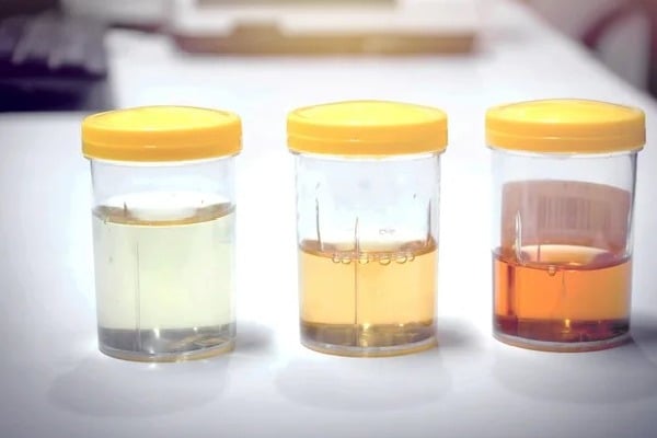 Heres what your urine colour is telling you about your health