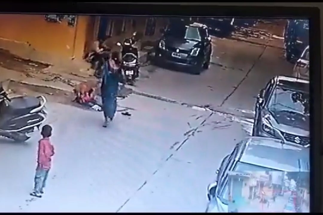 Hyderabad boy seriously injured in stray dog attack