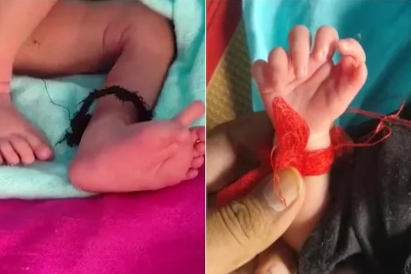 Baby with 26 fingers born in Rajasthan family saying it is goddess incarnation
