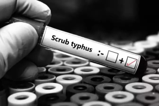 Scrub Typhus Virus Reported In Maharashtra