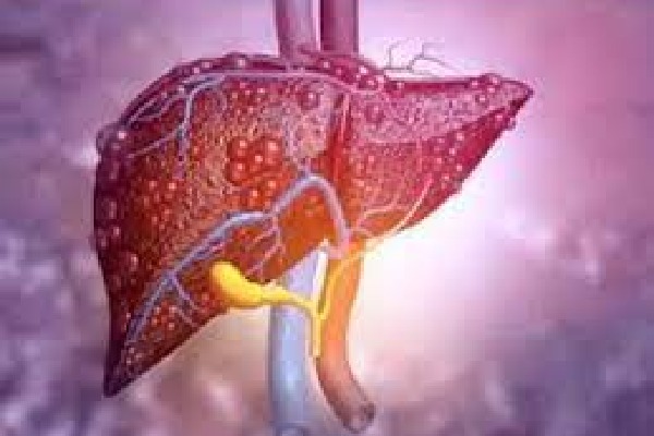 AI offers promise for earlier & accurate liver cancer diagnosis