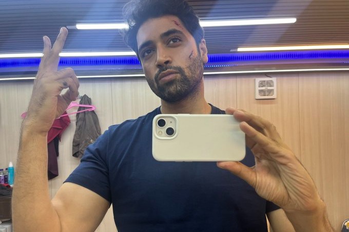 Adivi Sesh shares BTS picture with scars from sets of 'G2'