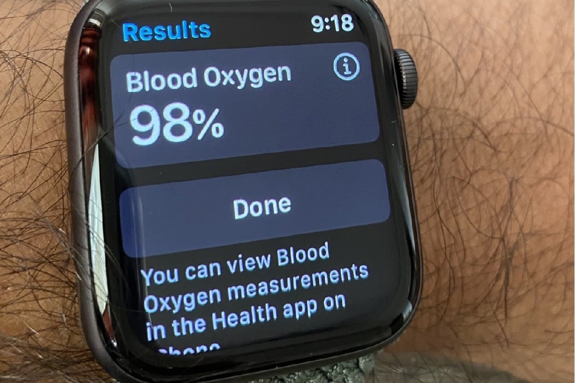Doctor uses Apple Watch's banned blood O2 feature to save passenger mid-air