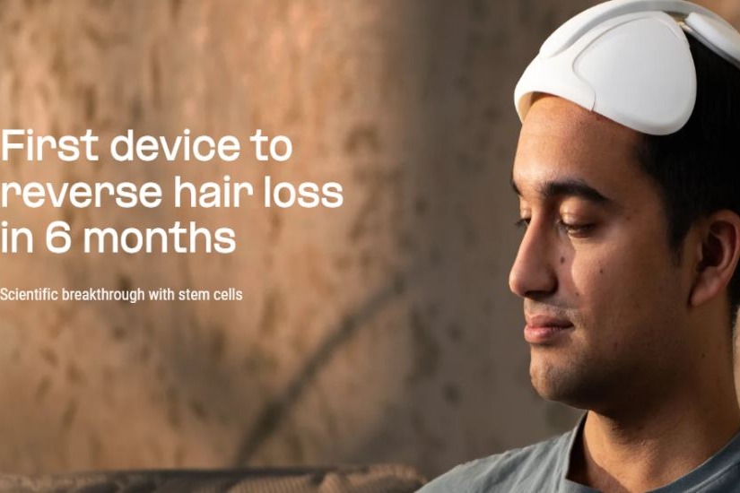 Austrian firm niostem lauches wearable device that cures baldness in men