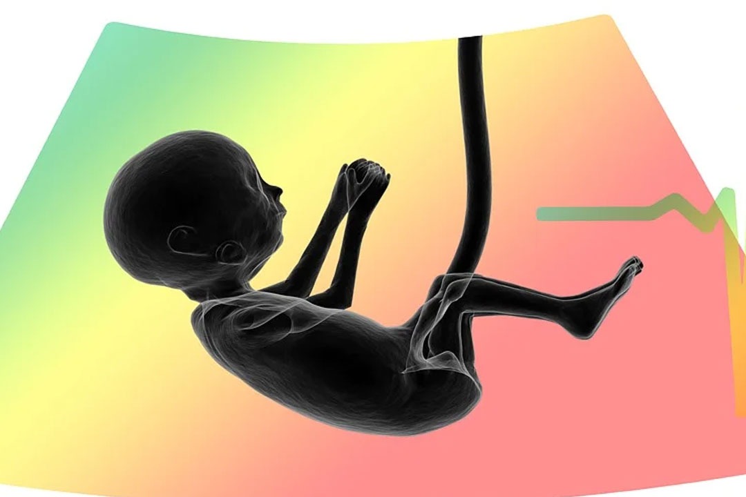IIT Madras researchers develop AI model to determine the age of a foetus with THSTI