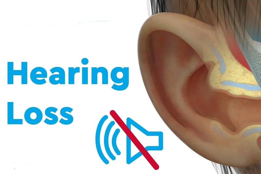 Hearing loss: Early screening, diagnosis is key to ensue 'sound' future for children