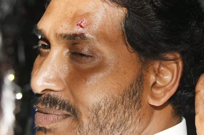 Andhra CM hit by stone during campaigning in Vijayawada