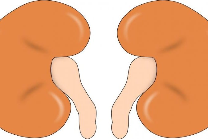 Harvested kidney transported to waiting recipient in Mohali in 10 minutes