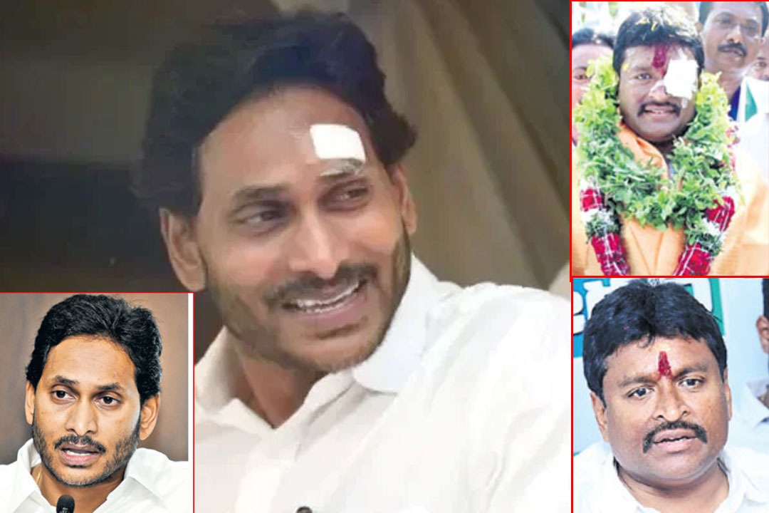 YS Jagan removed plaster from forehead then followed Vellampalli Srinivasa Rao