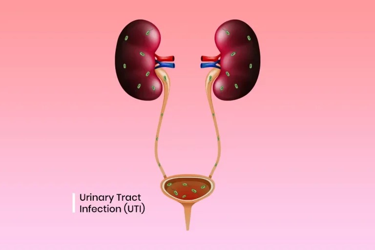 Study shows how E. coli causes urinary tract infections