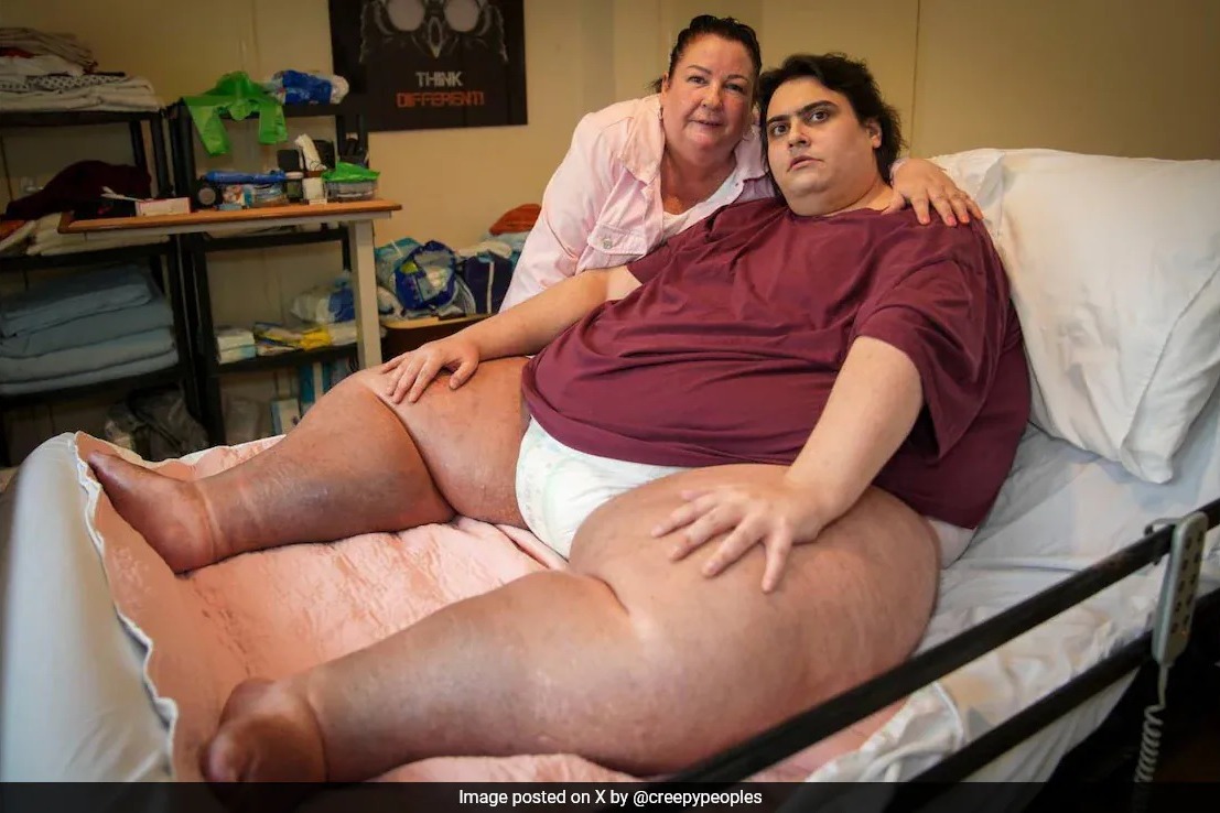 uk heaviest man dies of organ failure days before turning 34