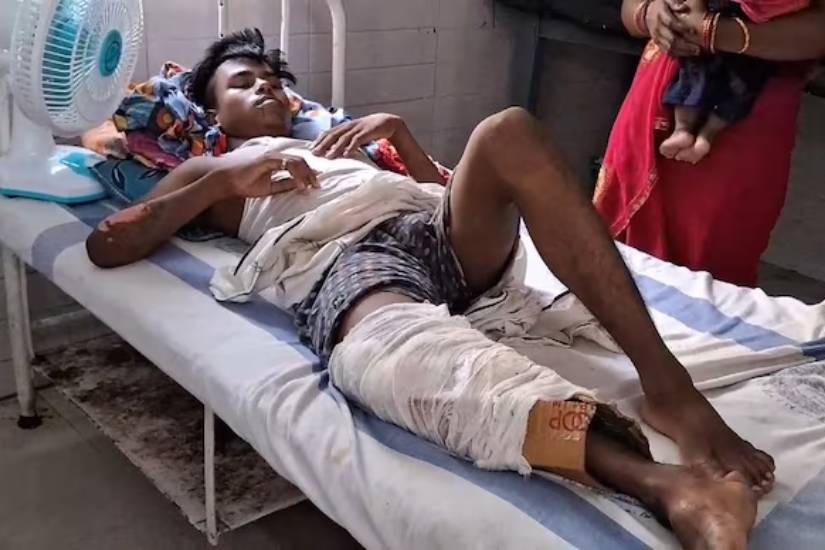 Bihar man goes to hospital with fractured bone they put cardboard cast on his leg
