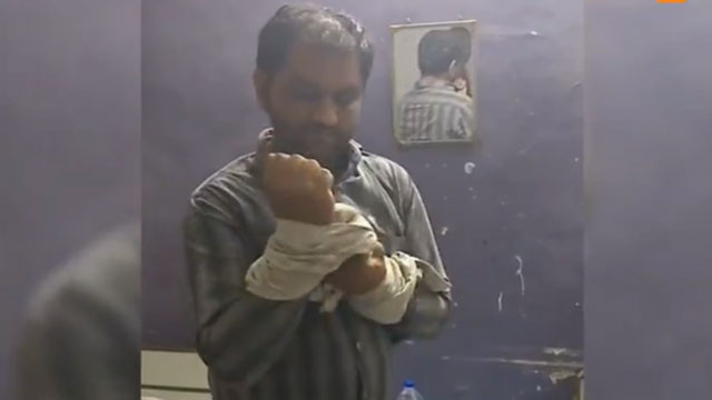 Jignesh Laljibhai Talavia fakes kidnapping for 50 lakhs after stock market losses