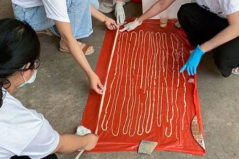 59 foot long tapeworm discovered inside mans intestines