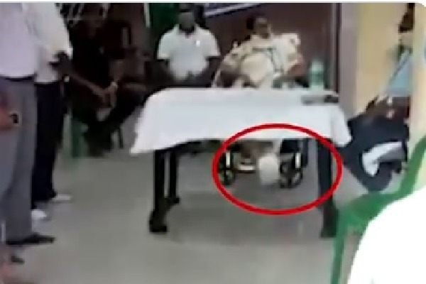 Mamata seen shaking injured leg