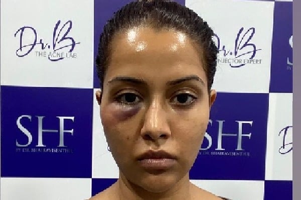 Raiza Wilson alleges skin care expert damages her face with false treatment 