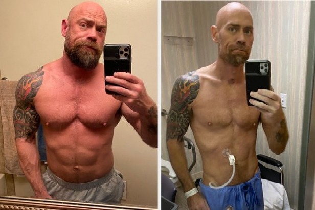 Corona causes massive weight loss in a Californian bodybuilder