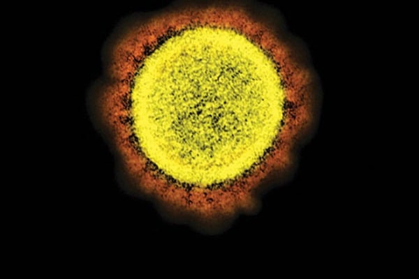 Photos of Corona virus captured by US scientists