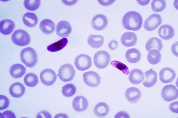 New type of Malaria emerges in Kerala