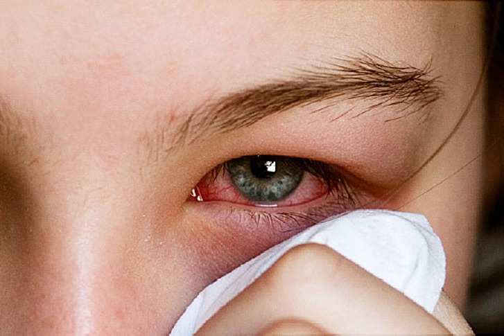 pink eye may be one of the covid symptom