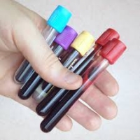 Novel blood test may detect, locate cancer early