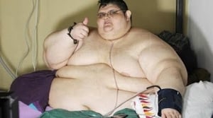 World's most obese man to undergo surgery