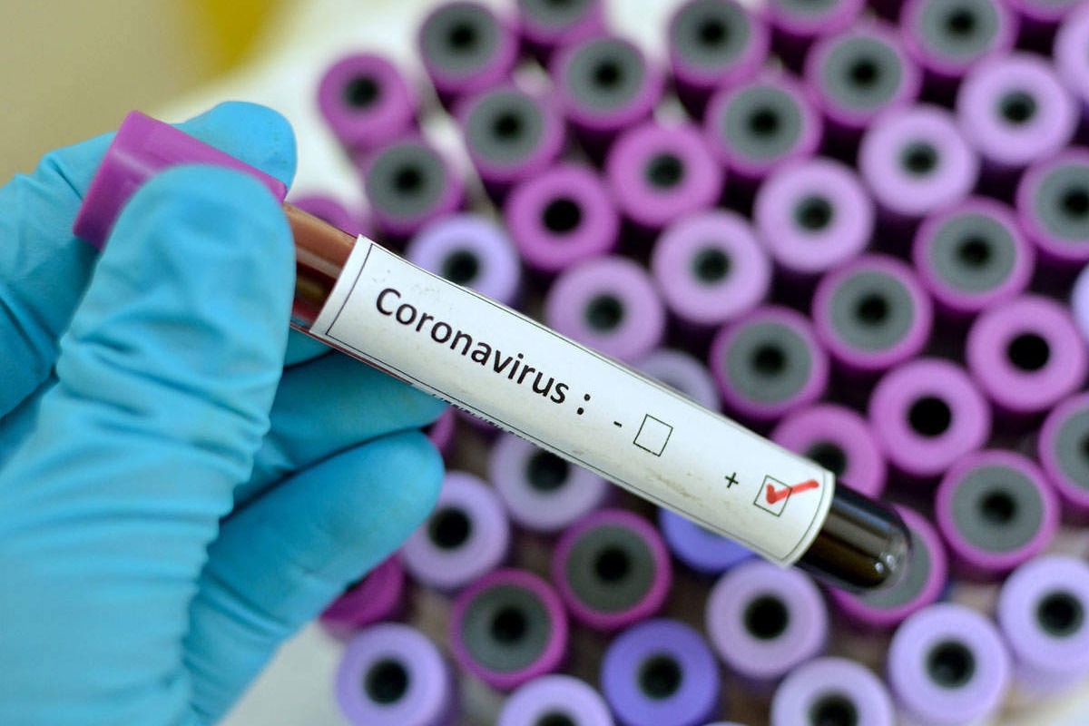 ICMR Recomends Faster Testing of Corona Virus
