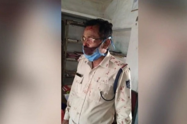 Cop injured as locals attack police