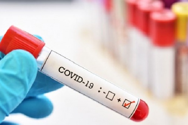 woman home guard infected to coronavirus in visakha