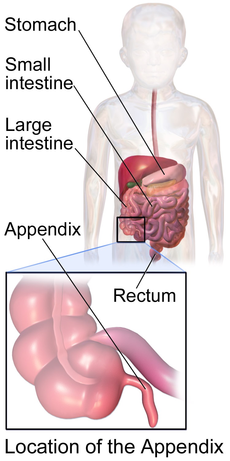 representational image