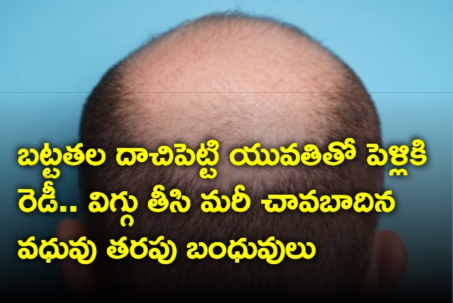 groom covered his bald head with a wig relatives crushed to know the truth 